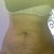 1 week before surgery i try to hold my breath!!