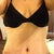 3 Weeks Post Op