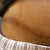 Right side of scar