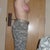 four weeks post op
