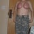 four weeks post op