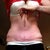 How much skin I can grab! Post op?