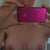 8 weeks post op