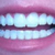 After, I still have a few attachments on the bottom but they aren't that noticeable. With only a week left on the bottom and all finished on the top this is basically the final look.