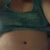 my scar end of 2nd week... and my slow to heal belly button. Looking a bit swollen.