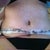 first day I saw my new tummy!!