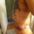 side view swollen and bruised