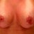 6 weeks wish my boob would heal