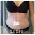 12 weeks PO: progression pics are the best way to snap out of a post operative funk!!