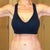 3.5 months post op.