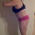 10 days post op
