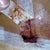 The beginning of the hematoma causing problems