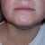 chin before