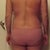 back view 9wks