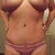 closer look at tummy scar 9wks