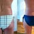 5 1/2 weeks Post-Op: Swimsuit comparison