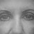Eyes before fat graft, canthopexy and browlift-taken by a PS May 2012