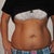 front view of tummy before TT