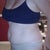 BEFORE Side view of belly