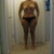15 days post op still swollen around the tummy and thighs and my right breast is still lower than the left due to swelling