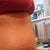six days post op