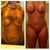 Before/ 6 weeks