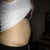 see the bulging area above belly button.