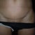 mini tummy tuck scar at 7 mo.