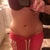 4 months post op