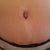 12 Weeks PO - another pic of belly