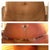 Top picture is before the other two are after tummy tuck