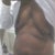 Before the surgery