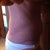This is a side view at 9 weeks.  As you can see I'm still very thick and swollen. YUCK! My before pic looks better. :(