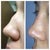 profile before and after... hump still there