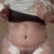 1 week Post-OP