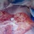 my doc took pics. this is what they do! sew it all up