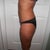 6 weeks after surgery