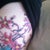 Close up 24 hrs after 1st session. Starting to see some lines fading already.
