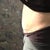 Side view 2 1/2 weeks PO