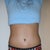 Post Op 4 Weeks - I love the results
