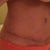 7 weeks po