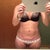 Front approx one month pre op
