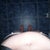 Day 40 - 5 and half wks - bulge still there to the right, breathing in