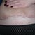 Day 40 - 5 and half wks - pulling my skin up so you can see the cut better by which the upward curve tells you there's still skin hanging around