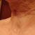 Post op 3 wks