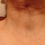 Post op 3 wks