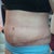 2 weeks left side