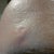 Notice the rough texture of my forehead.