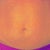 Stomach 48 hours After (no more tattoo)