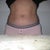before abs